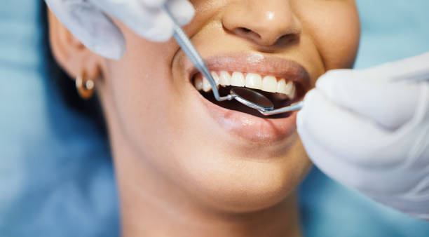 Best Teeth Whitening  in Shoshone, ID
